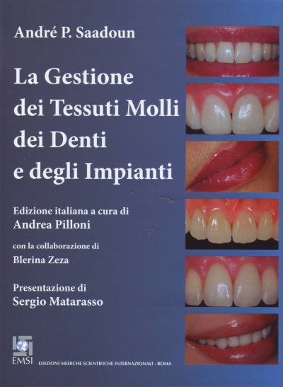 La gestione dei tessuti molli dei denti e degli impianti